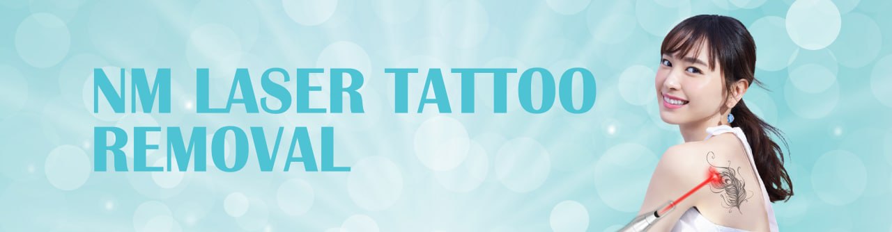 laser-tattoo-removal-malaysia