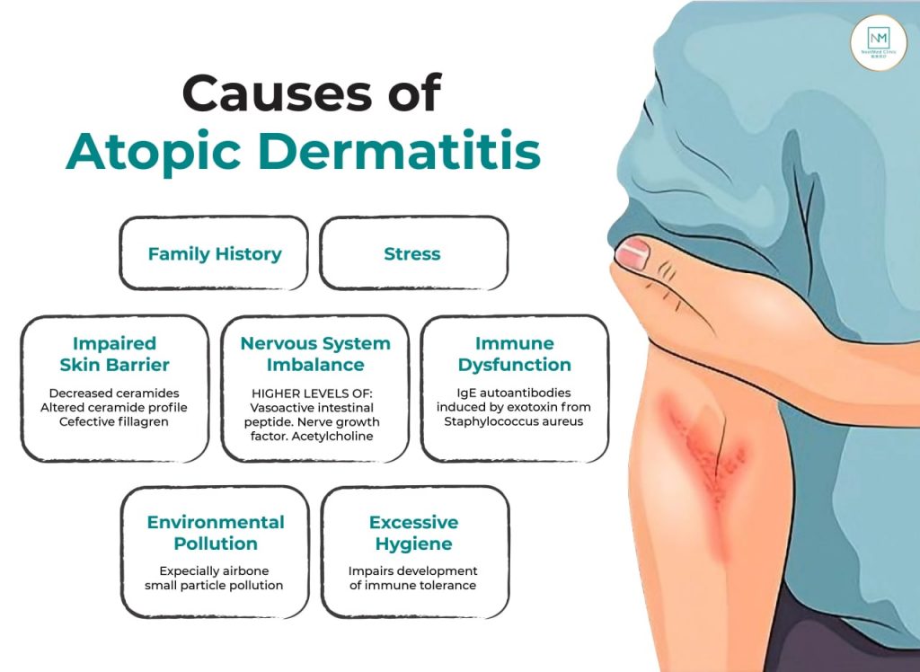 causes-atopic-dermatitis