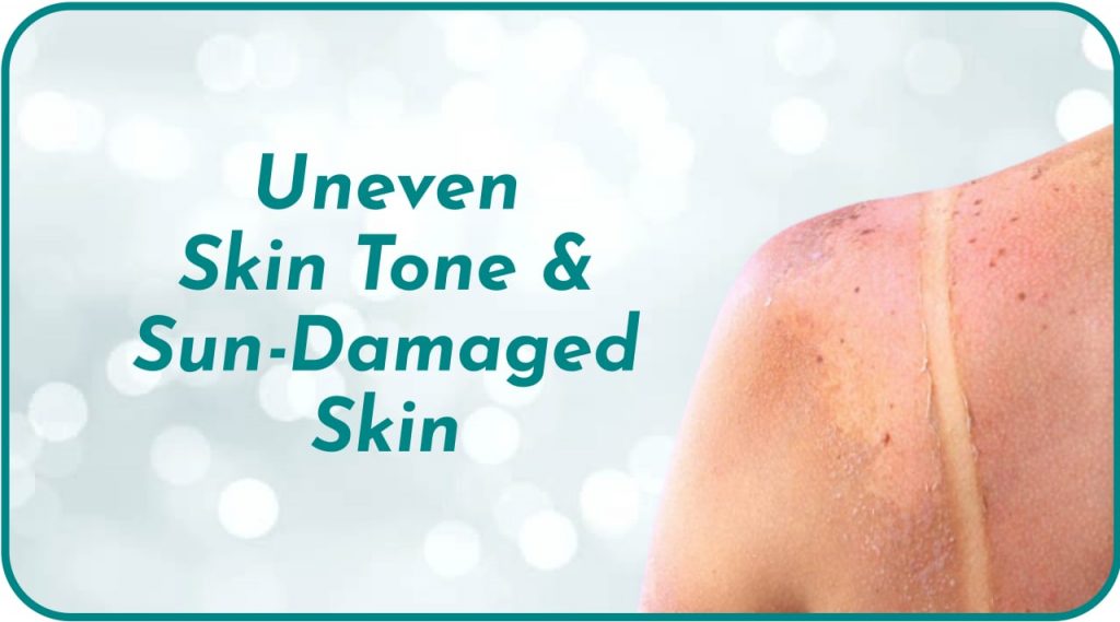 uneven skin tone sun-damaged skin