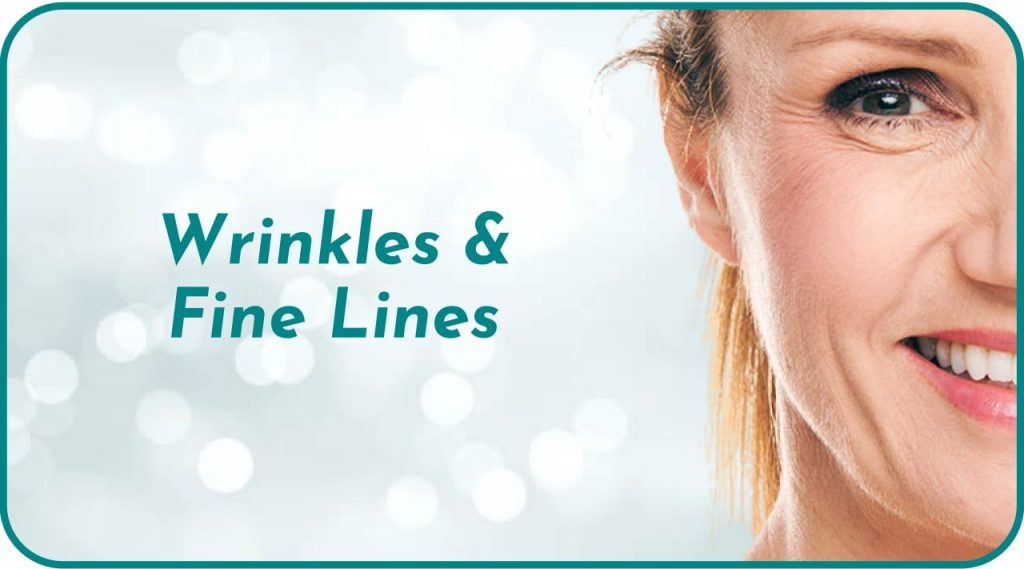 wrinkles fine lines